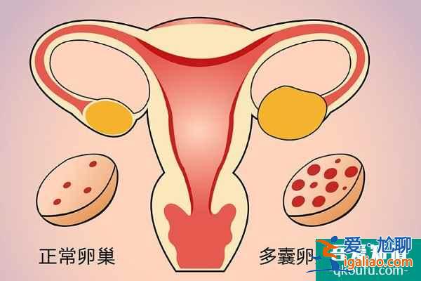 泰國試管嬰兒專家：探究引起不孕癥的原因與好孕方案？