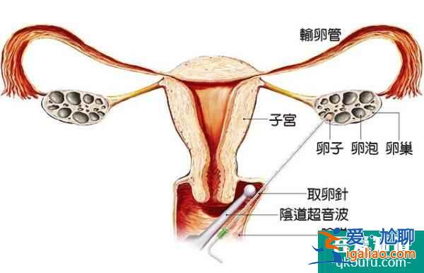 試管嬰兒周期中有哪些注意事項(xiàng)？？