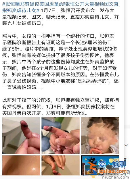 張恒指控鄭爽虐童!孩子手指撕裂縫數針 視頻曝光孩子語出驚人