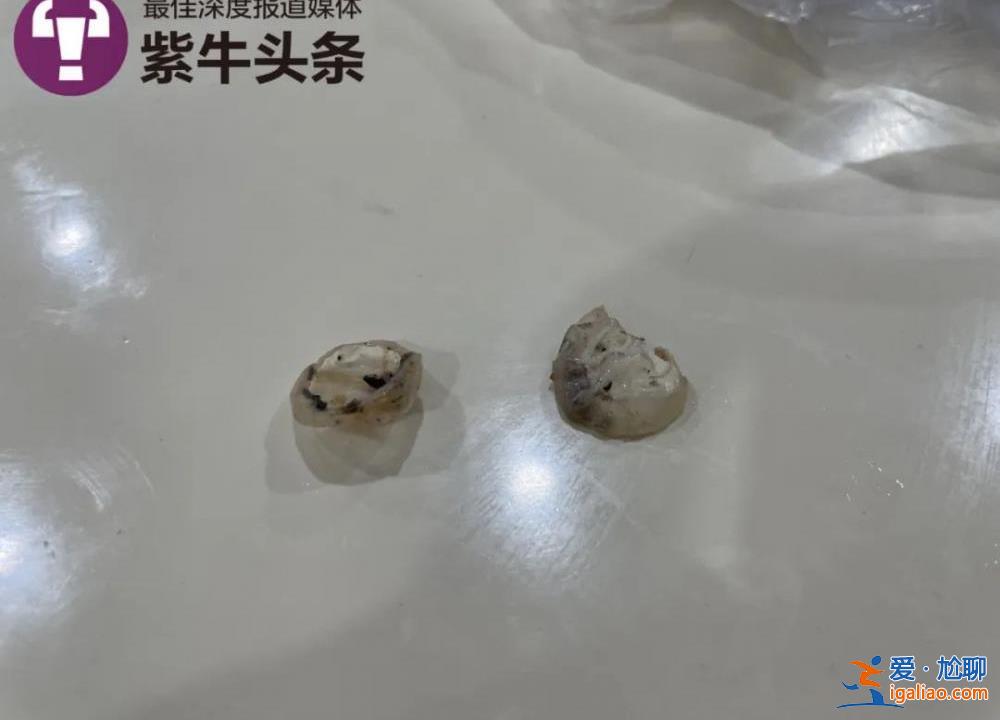 食堂飯菜異物是鴨子眼球鞏膜？現場實測鴨眼球鞏膜比鴨眼外表大數倍？